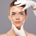 Are facelift results permanent