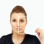 Revision Blepharoplasty