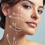 Types of SMAS facelift
