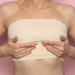 Swelling and bruising after breast reduction
